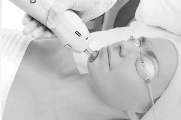 Skin Resurfacing Gesicht Laserbehandlung
